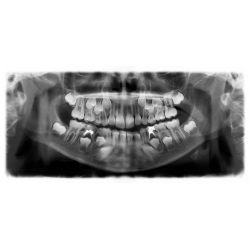 LES LEÇONS NUMÉRIQUES QUESTIONNER LE MONDE –  Les comportements favorables à la santé